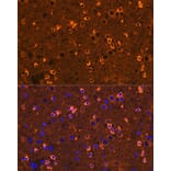 Immunofluorescence - Anti-CRMP2 Antibody [ARC1123] (A308146) - Antibodies.com