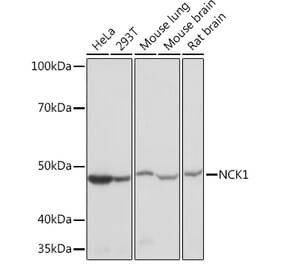 Western Blot - Anti-Nck Antibody [ARC1441] (A308147) - Antibodies.com