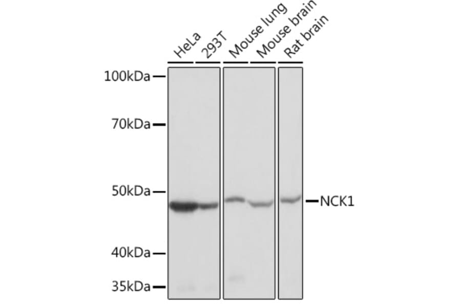 Western Blot - Anti-Nck Antibody [ARC1441] (A308147) - Antibodies.com