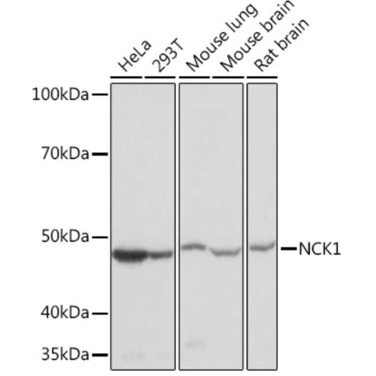Western Blot - Anti-Nck Antibody [ARC1441] (A308147) - Antibodies.com