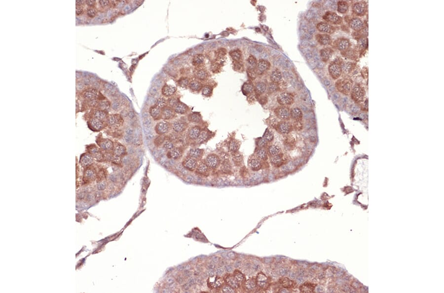 Immunohistochemistry - Anti-Nck Antibody [ARC1441] (A308147) - Antibodies.com