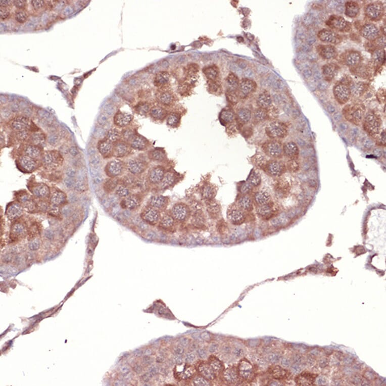 Immunohistochemistry - Anti-Nck Antibody [ARC1441] (A308147) - Antibodies.com