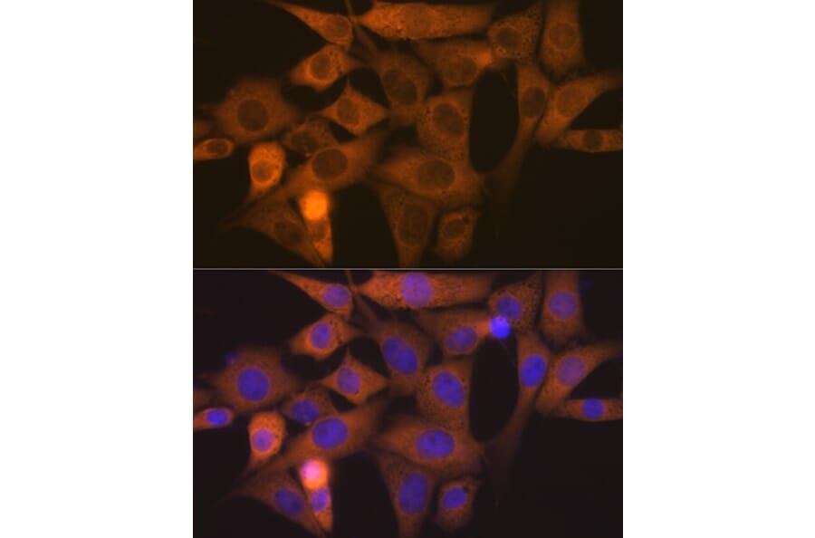 Immunofluorescence - Anti-Nck Antibody [ARC1441] (A308147) - Antibodies.com