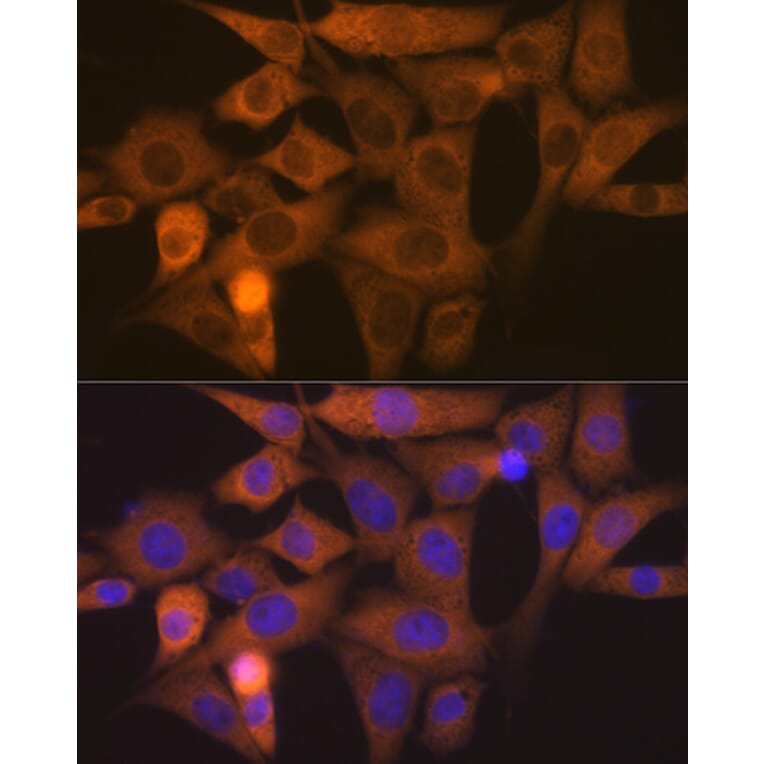 Immunofluorescence - Anti-Nck Antibody [ARC1441] (A308147) - Antibodies.com