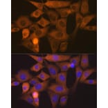 Immunofluorescence - Anti-Nck Antibody [ARC1441] (A308147) - Antibodies.com
