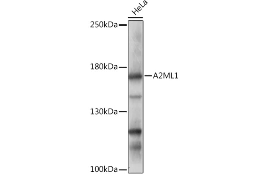Western Blot - Anti-A2ML1 Antibody (A308148) - Antibodies.com
