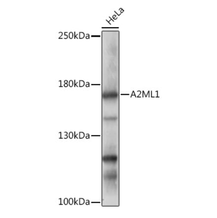 Western Blot - Anti-A2ML1 Antibody (A308148) - Antibodies.com