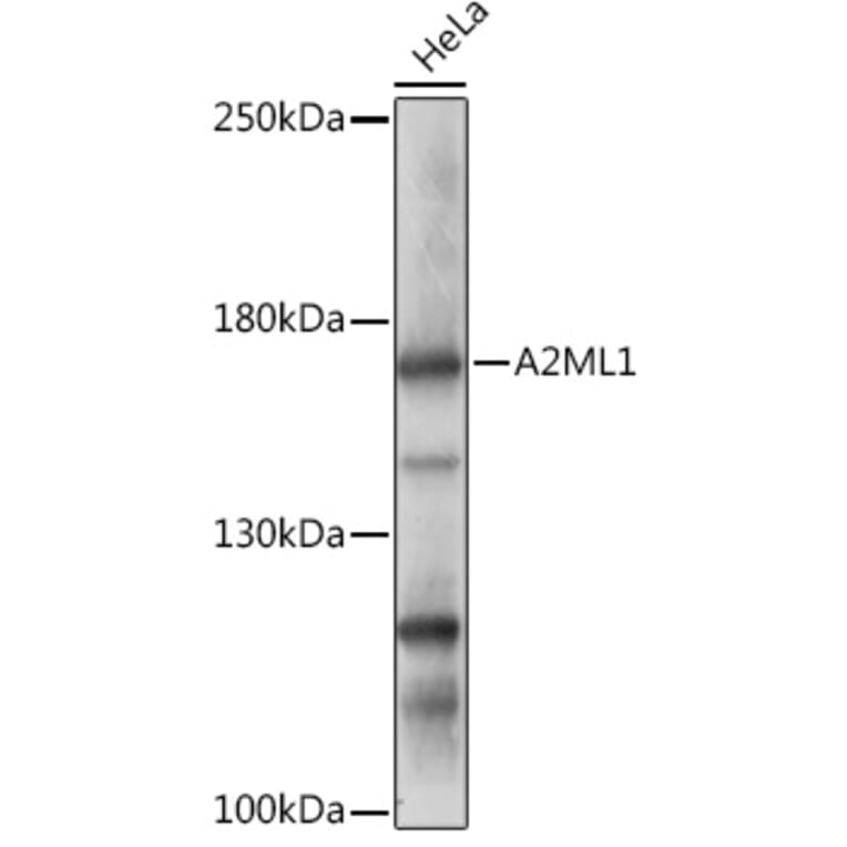 Western Blot - Anti-A2ML1 Antibody (A308148) - Antibodies.com