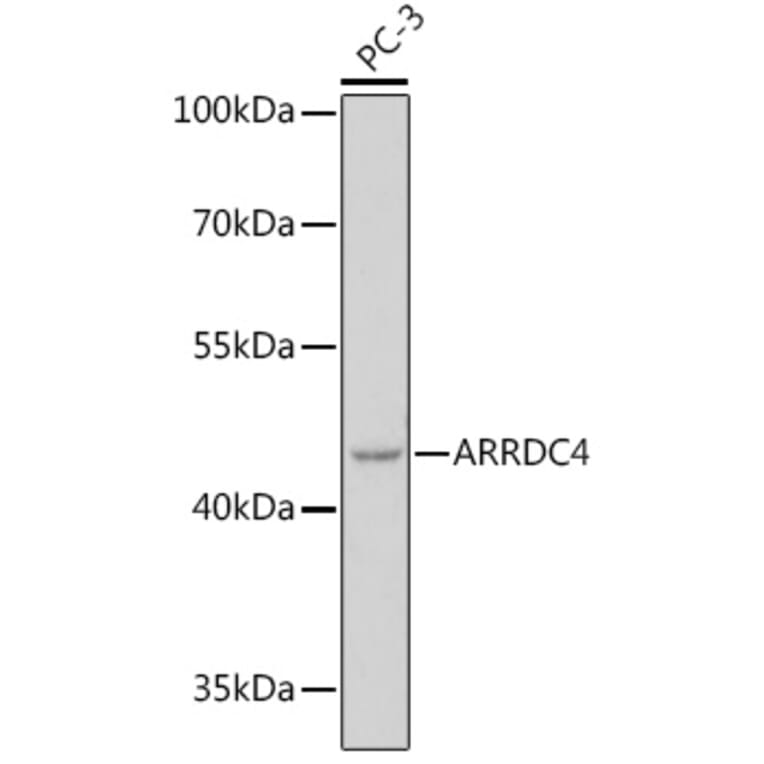 Western Blot - Anti-ARRDC4 Antibody (A308150) - Antibodies.com