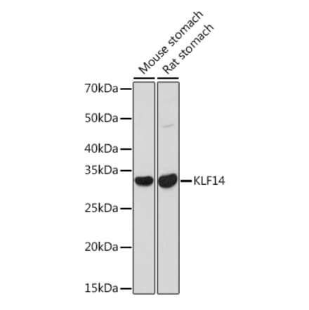 Western Blot - Anti-KLF14 Antibody (A308151) - Antibodies.com