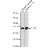 Western Blot - Anti-KLF14 Antibody (A308151) - Antibodies.com