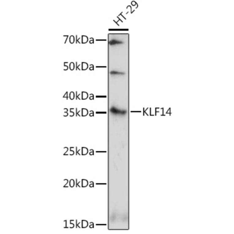 Western Blot - Anti-KLF14 Antibody (A308151) - Antibodies.com