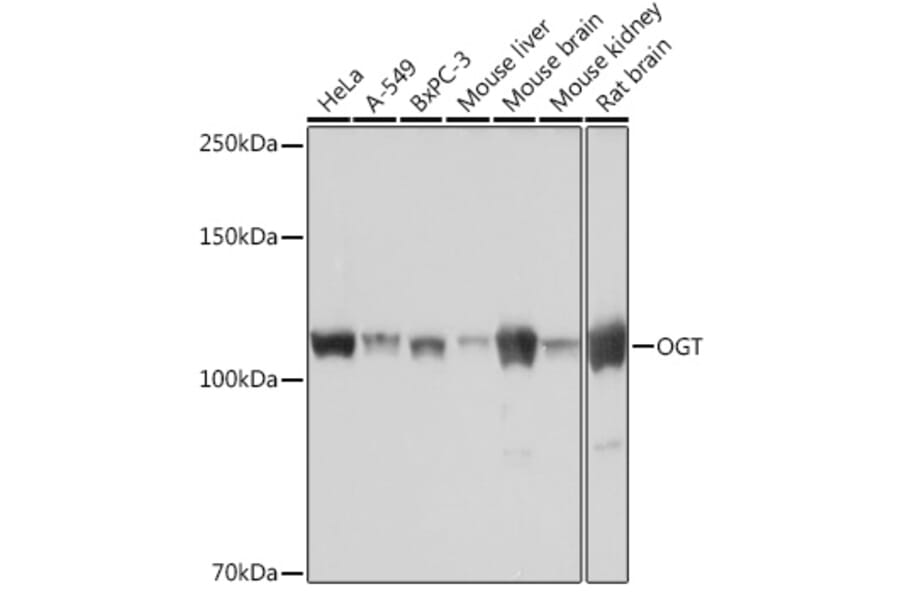 Western Blot - Anti-OGT/O-Linked N-Acetylglucosamine Transferase Antibody [ARC0790] (A308152) - Antibodies.com