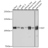 Western Blot - Anti-OGT/O-Linked N-Acetylglucosamine Transferase Antibody [ARC0790] (A308152) - Antibodies.com