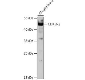 Western Blot - Anti-p39 Antibody (A308153) - Antibodies.com
