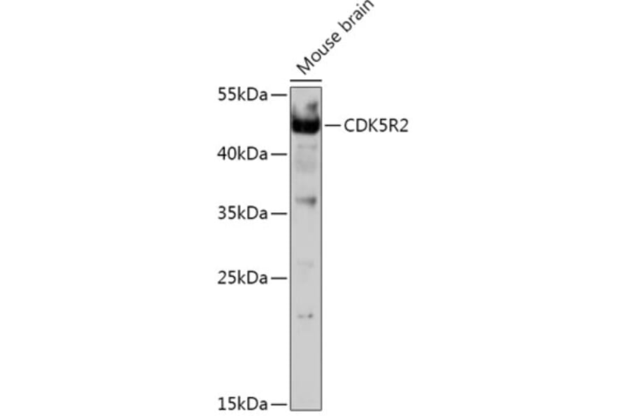 Western Blot - Anti-p39 Antibody (A308153) - Antibodies.com