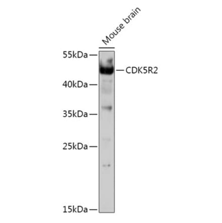 Western Blot - Anti-p39 Antibody (A308153) - Antibodies.com