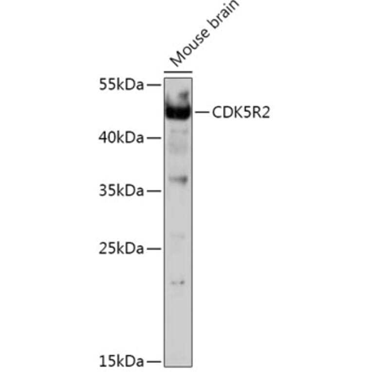 Western Blot - Anti-p39 Antibody (A308153) - Antibodies.com