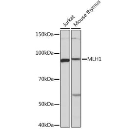 Western Blot - Anti-MLH1 Antibody [ARC53543] (A308155) - Antibodies.com