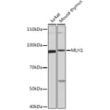 Western Blot - Anti-MLH1 Antibody [ARC53543] (A308155) - Antibodies.com