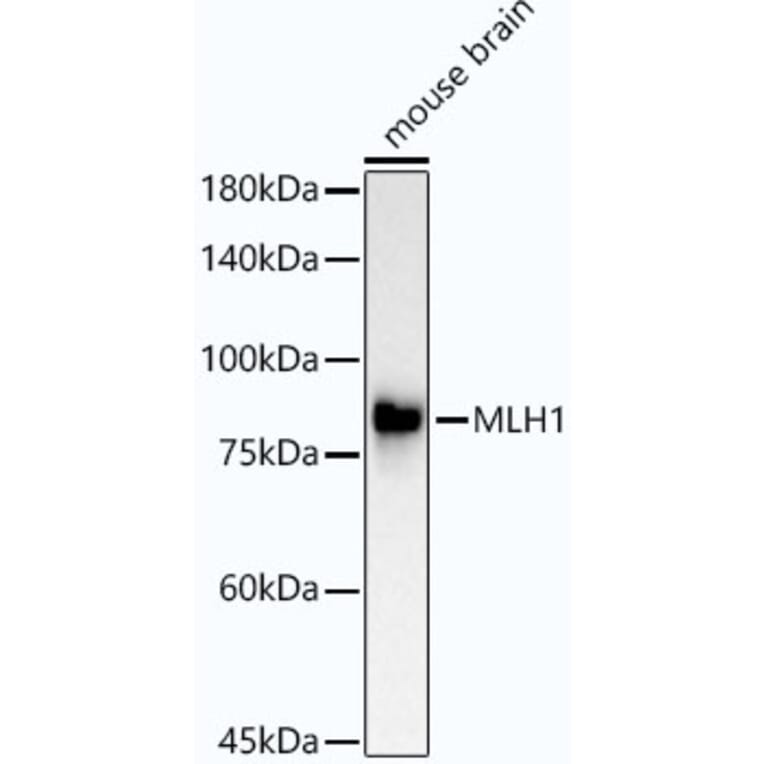 Western Blot - Anti-MLH1 Antibody [ARC53543] (A308155) - Antibodies.com