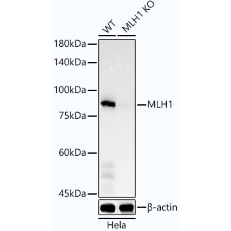 Western Blot - Anti-MLH1 Antibody [ARC53543] (A308155) - Antibodies.com