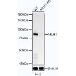 Western Blot - Anti-MLH1 Antibody [ARC53543] (A308155) - Antibodies.com