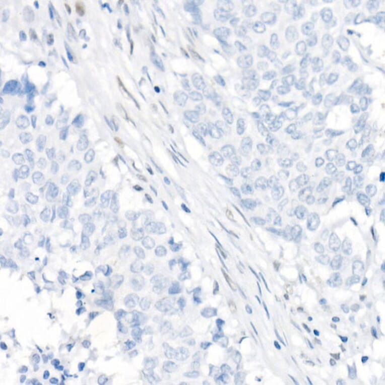 Immunohistochemistry - Anti-MLH1 Antibody [ARC53543] (A308155) - Antibodies.com