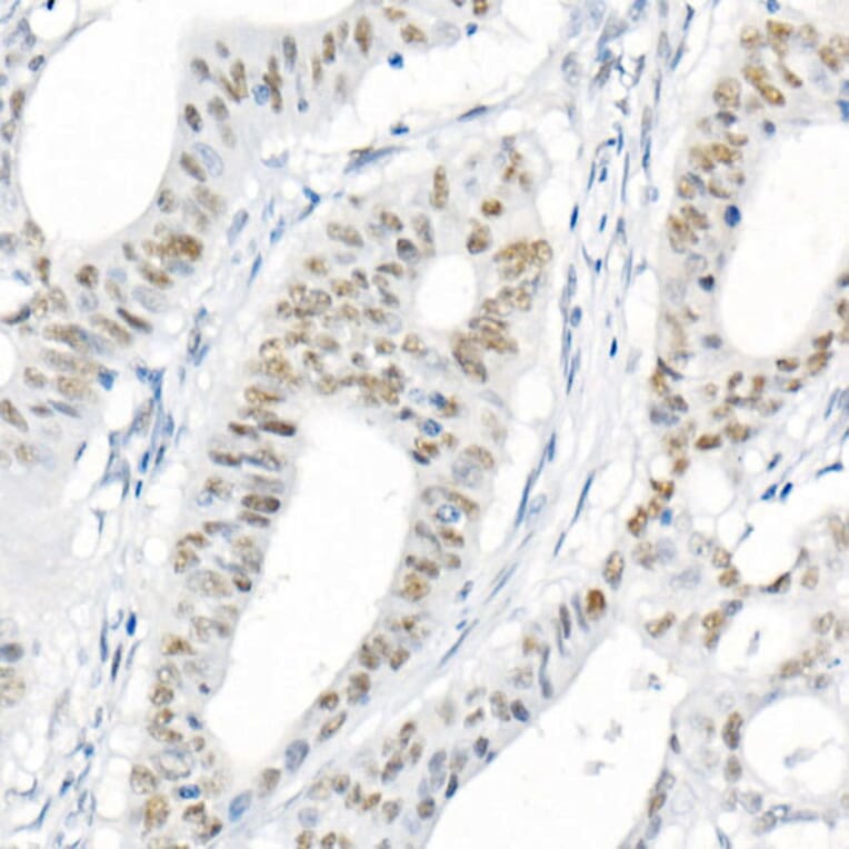 Immunohistochemistry - Anti-MLH1 Antibody [ARC53543] (A308155) - Antibodies.com