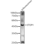 Western Blot - Anti-STOP1 Antibody (A308156) - Antibodies.com