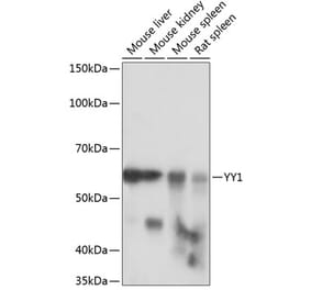 Western Blot - Anti-YY1 Antibody [ARC0048] (A308157) - Antibodies.com