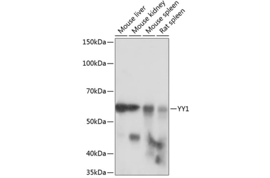 Western Blot - Anti-YY1 Antibody [ARC0048] (A308157) - Antibodies.com