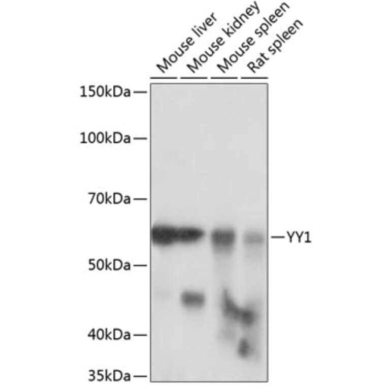 Western Blot - Anti-YY1 Antibody [ARC0048] (A308157) - Antibodies.com
