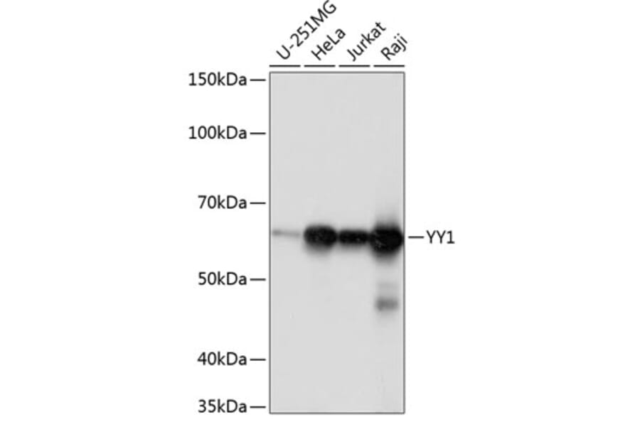 Western Blot - Anti-YY1 Antibody [ARC0048] (A308157) - Antibodies.com