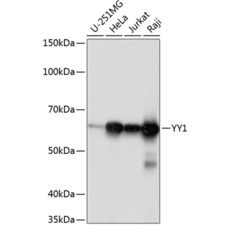 Western Blot - Anti-YY1 Antibody [ARC0048] (A308157) - Antibodies.com