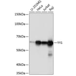 Western Blot - Anti-YY1 Antibody [ARC0048] (A308157) - Antibodies.com