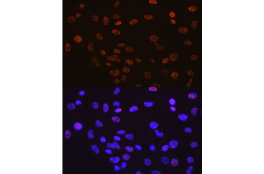 Immunofluorescence - Anti-YY1 Antibody [ARC0048] (A308157) - Antibodies.com