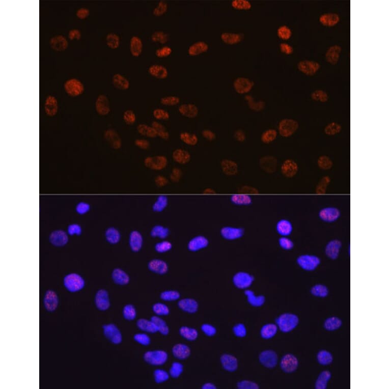 Immunofluorescence - Anti-YY1 Antibody [ARC0048] (A308157) - Antibodies.com