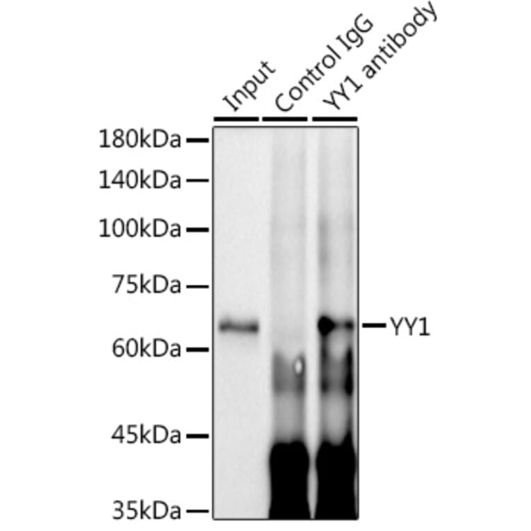 Western Blot - Anti-YY1 Antibody [ARC0048] (A308157) - Antibodies.com