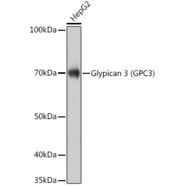 Western Blot - Anti-Glypican 3 Antibody [ARC0675] (A308158) - Antibodies.com