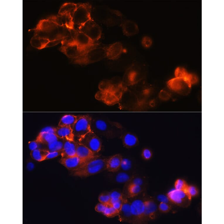 Immunofluorescence - Anti-Glypican 3 Antibody [ARC0675] (A308158) - Antibodies.com