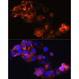 Immunofluorescence - Anti-Glypican 3 Antibody [ARC0675] (A308158) - Antibodies.com