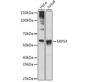 Western Blot - Anti-SRP54 Antibody [ARC1904] (A308160) - Antibodies.com
