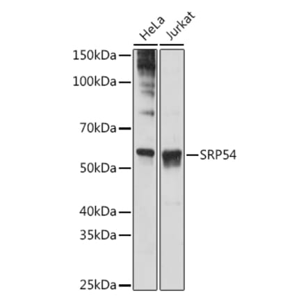 Western Blot - Anti-SRP54 Antibody [ARC1904] (A308160) - Antibodies.com