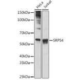 Western Blot - Anti-SRP54 Antibody [ARC1904] (A308160) - Antibodies.com