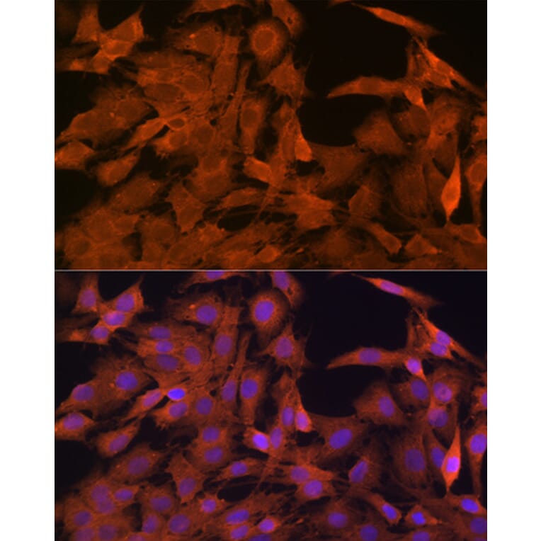 Immunofluorescence - Anti-SRP54 Antibody [ARC1904] (A308160) - Antibodies.com