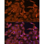 Immunofluorescence - Anti-SRP54 Antibody [ARC1904] (A308160) - Antibodies.com
