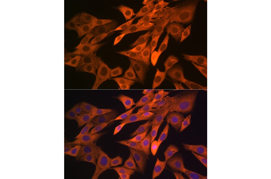 Immunofluorescence - Anti-SRP54 Antibody [ARC1904] (A308160) - Antibodies.com