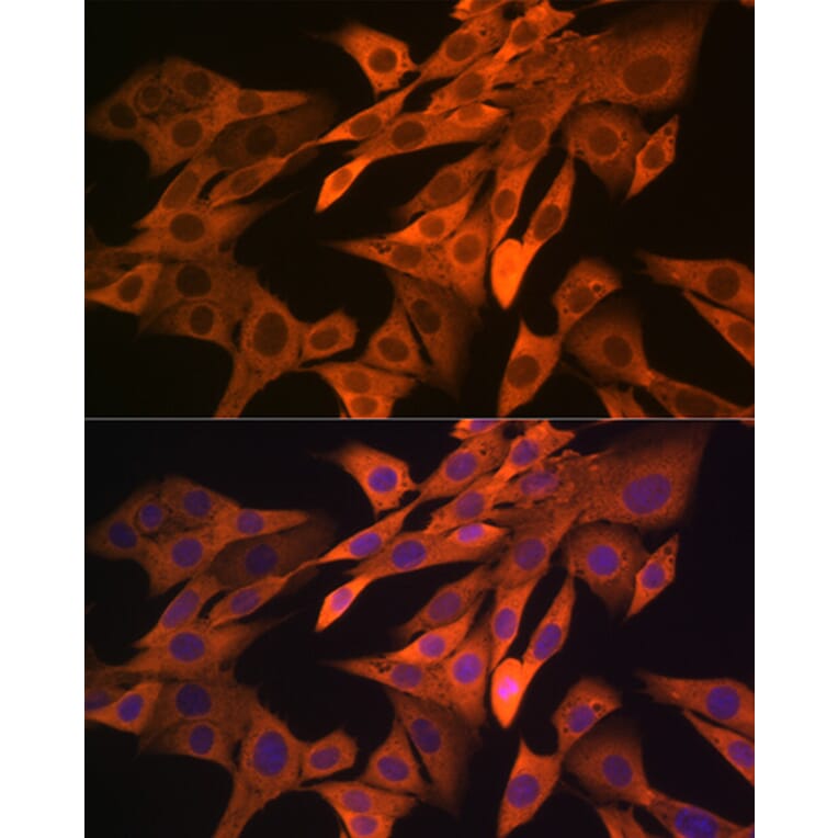 Immunofluorescence - Anti-SRP54 Antibody [ARC1904] (A308160) - Antibodies.com