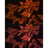 Immunofluorescence - Anti-SRP54 Antibody [ARC1904] (A308160) - Antibodies.com